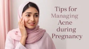 Tips for Managing Acne during Pregnancy